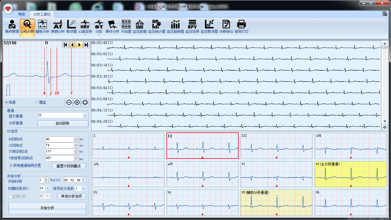 CB系列心电血压回顾分析系统PRO版