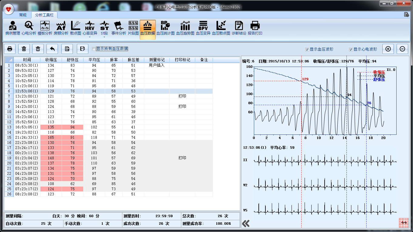 ECG Analysis System V9.1.1